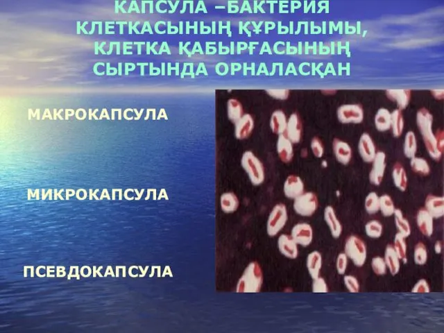 КАПСУЛА –БАКТЕРИЯ КЛЕТКАСЫНЫҢ ҚҰРЫЛЫМЫ, КЛЕТКА ҚАБЫРҒАСЫНЫҢ СЫРТЫНДА ОРНАЛАСҚАН МАКРОКАПСУЛА МИКРОКАПСУЛА ПСЕВДОКАПСУЛА