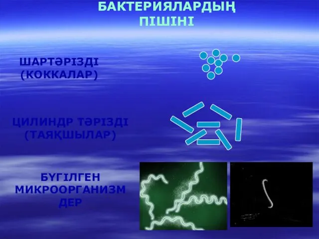 БАКТЕРИЯЛАРДЫҢ ПІШІНІ ШАРТӘРІЗДІ (КОККАЛАР) ЦИЛИНДР ТӘРІЗДІ (ТАЯҚШЫЛАР) БҮГІЛГЕН МИКРООРГАНИЗМДЕР