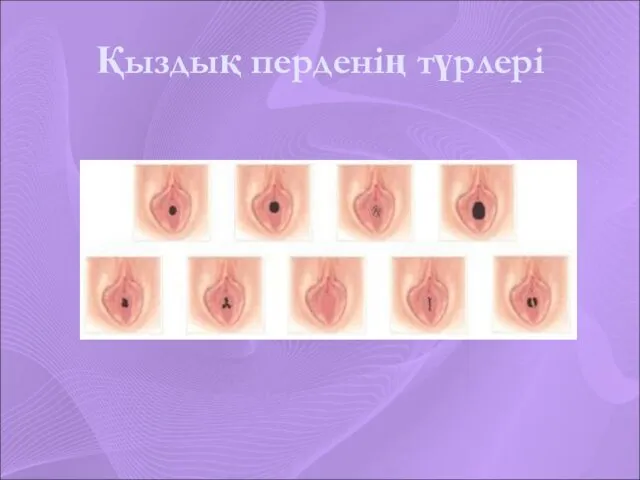 Қыздық перденің түрлері