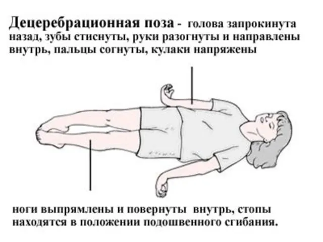 Функции Среднего мозга