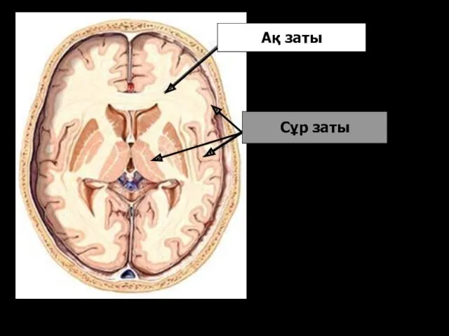 Ақ заты Сұр заты