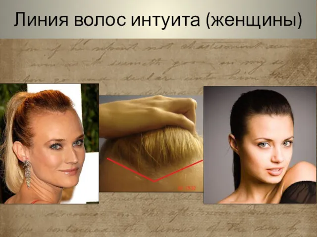 Линия волос интуита (женщины)