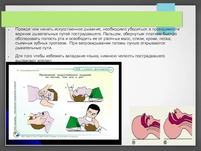 Прежде чем начать искусственное дыхание, необходимо убедиться в проходимости верхних