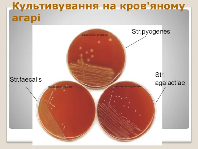 Культивування на кров'яному агарі Str.pyogenes Str. agalactiae Str.faecalis