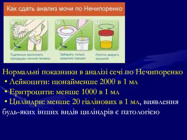 Нормальні показники в аналізі сечі по Нечипоренко • Лейкоцити: щонайменше