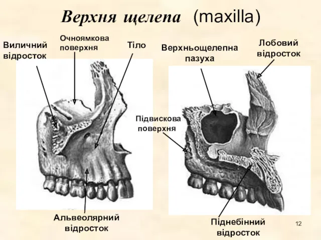 Верхня щелепа (maxilla) Очноямкова поверхня Підвискова поверхня