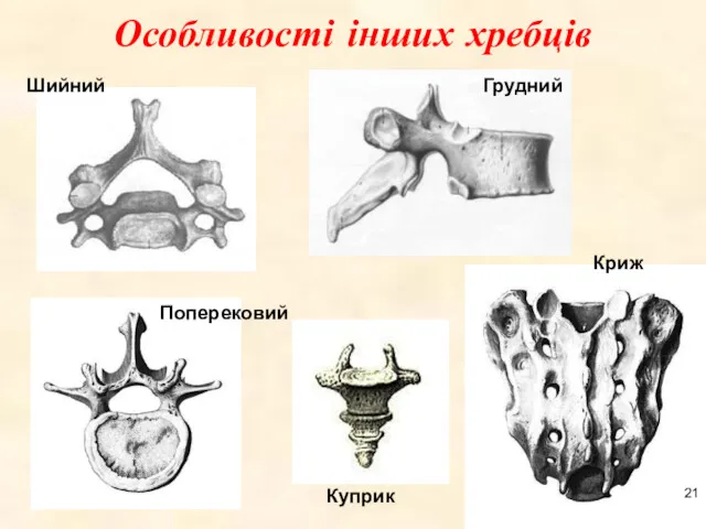 Особливості інших хребців