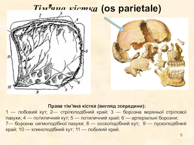 Тім’яна кістка (os parietale) Тім’яна кістка Права тім'яна кістка (вигляд
