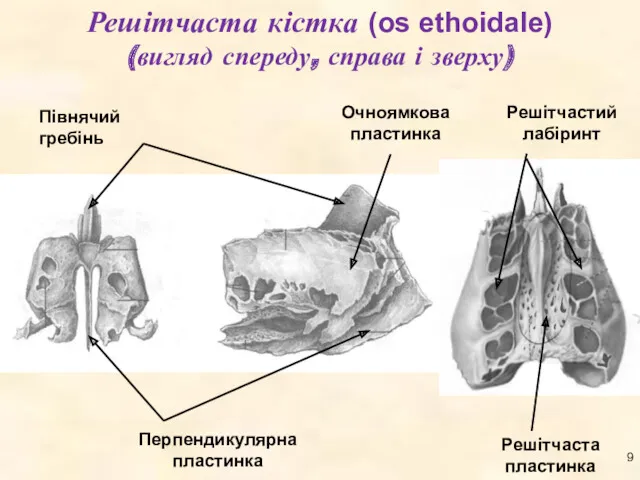 Решітчаста кістка (os ethoidale) (вигляд спереду, справа і зверху)