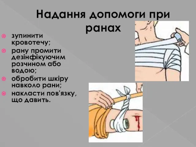 Надання допомоги при ранах зупинити кровотечу; рану промити дезінфікуючим розчином