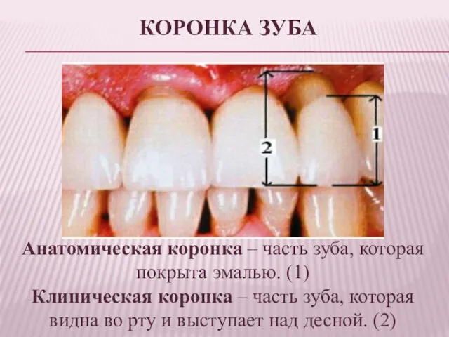 КОРОНКА ЗУБА Анатомическая коронка – часть зуба, которая покрыта эмалью.