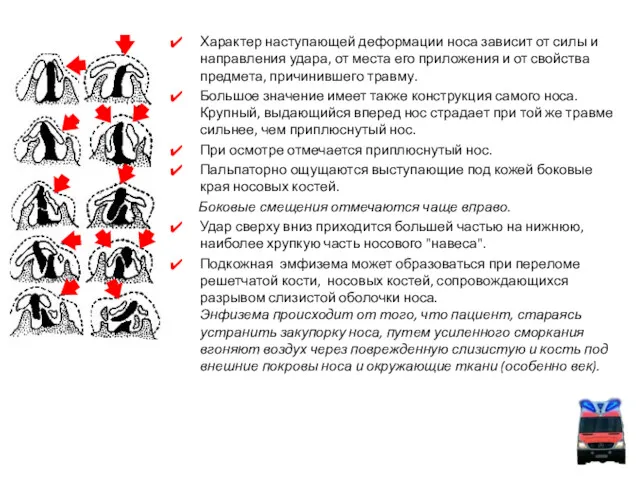 Характер наступающей деформации носа зависит от силы и направления удара,