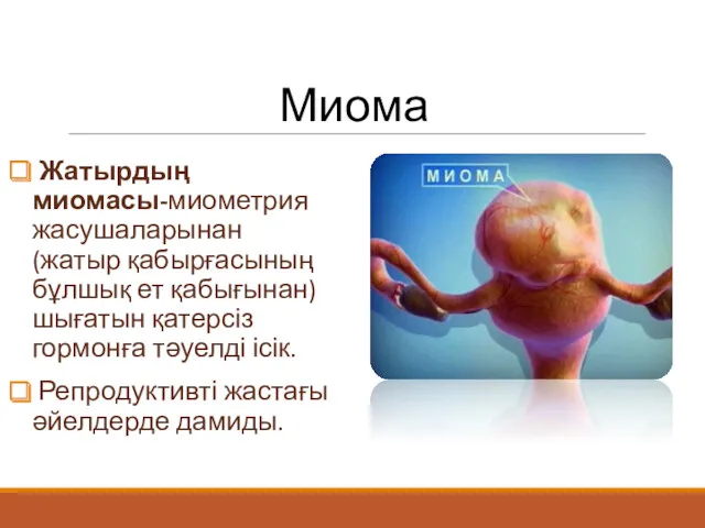 Миома Жатырдың миомасы-миометрия жасушаларынан (жатыр қабырғасының бұлшық ет қабығынан) шығатын қатерсіз гормонға тәуелді