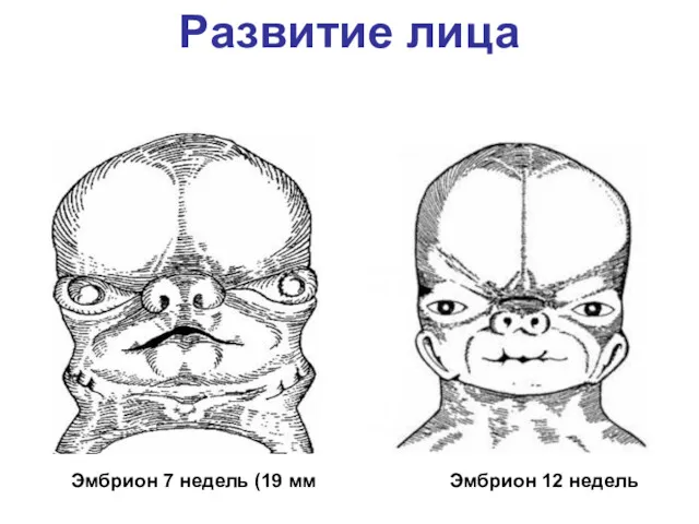 Развитие лица Эмбрион 12 недель Эмбрион 7 недель (19 мм