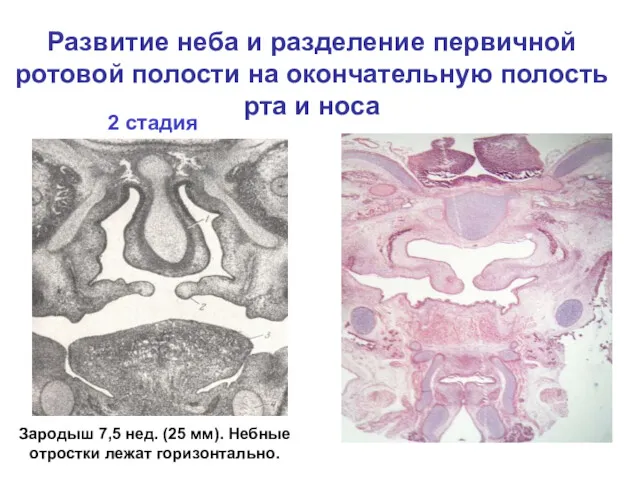Развитие неба и разделение первичной ротовой полости на окончательную полость