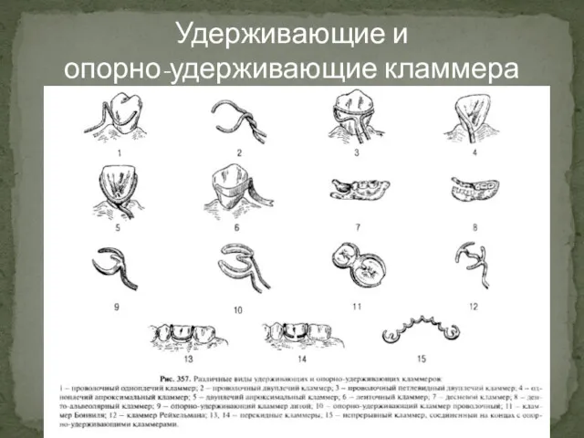 Удерживающие и опорно-удерживающие кламмера