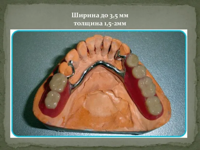 Ширина до 3,5 мм толщина 1,5-2мм