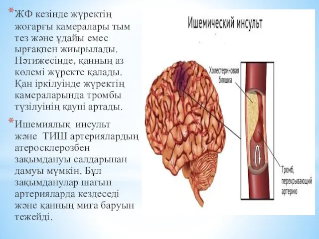 ЖФ кезінде жүректің жоғарғы камералары тым тез және ұдайы емес