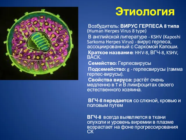 Этиология Возбудитель: ВИРУС ГЕРПЕСА 8 типа (Human Herpes Virus 8