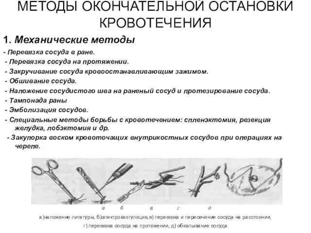 МЕТОДЫ ОКОНЧАТЕЛЬНОЙ ОСТАНОВКИ КРОВОТЕЧЕНИЯ 1. Механические методы - Перевязка сосуда