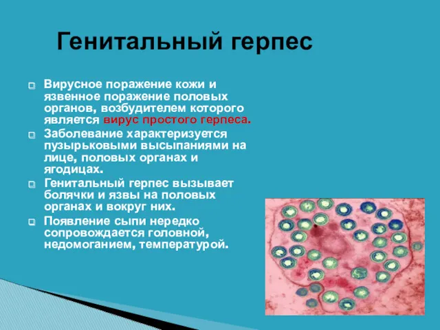 Вирусное поражение кожи и язвенное поражение половых органов, возбудителем которого