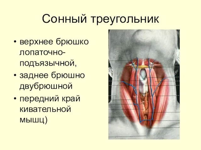 Сонный треугольник верхнее брюшко лопаточно-подъязычной, заднее брюшно двубрюшной передний край кивательной мышц)