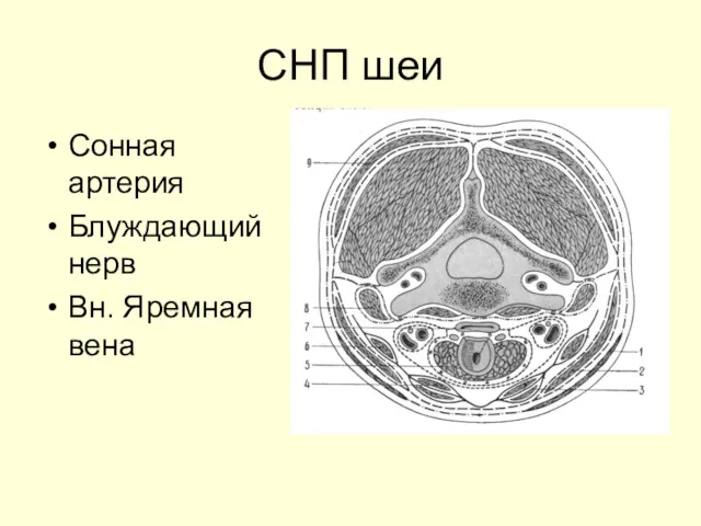 СНП шеи Сонная артерия Блуждающий нерв Вн. Яремная вена