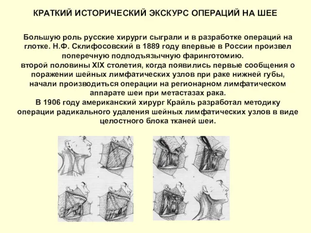 КРАТКИЙ ИСТОРИЧЕСКИЙ ЭКСКУРС ОПЕРАЦИЙ НА ШЕЕ Большую роль русские хирурги сыграли и в