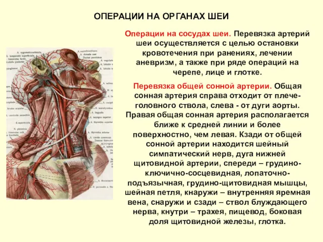 Операции на сосудах шеи. Перевязка артерий шеи осуществляется с целью остановки кровотечения при