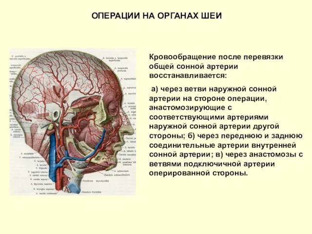 ОПЕРАЦИИ НА ОРГАНАХ ШЕИ Кровообращение после перевязки общей сонной артерии восстанавливается: а) через