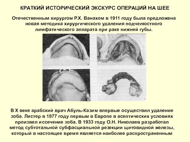 КРАТКИЙ ИСТОРИЧЕСКИЙ ЭКСКУРС ОПЕРАЦИЙ НА ШЕЕ Отечественным хирургом Р.Х. Ванахом в 1911 году