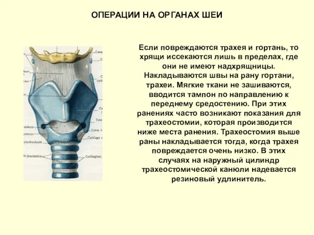 ОПЕРАЦИИ НА ОРГАНАХ ШЕИ Если повреждаются трахея и гортань, то