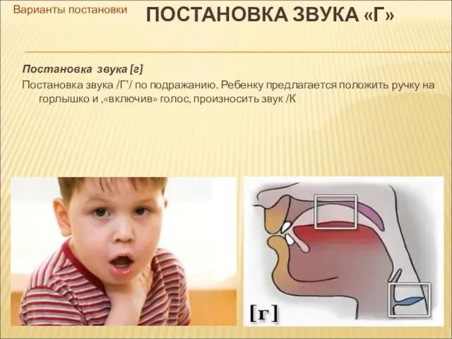 Варианты постановки ПОСТАНОВКА ЗВУКА «Г» Постановка звука [г] Постановка звука