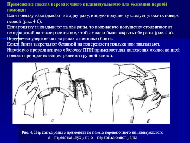 Применение пакета перевязочного индивидуального для оказания первой помощи: Если повязку