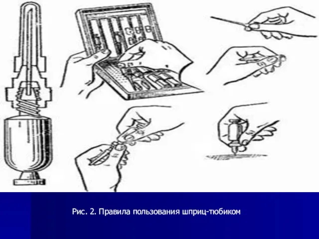 Рис. 2. Правила пользования шприц-тюбиком