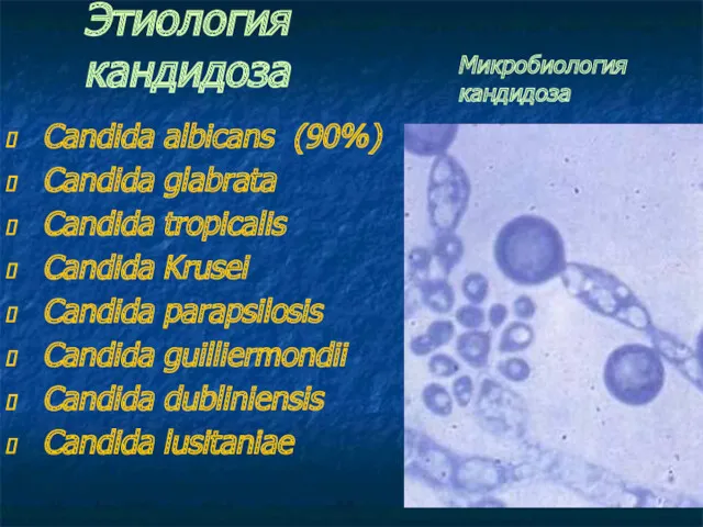 Этиология кандидоза Candida albicans (90%) Candida glabrata Candida tropicalis Candida