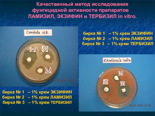 Качественный метод исследования фунгицидной активности препаратов ЛАМИЗИЛ, ЭКЗИФИН и ТЕРБИЗИЛ