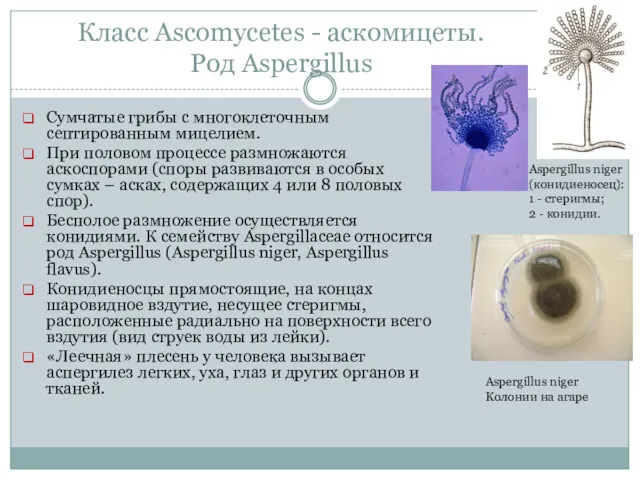 Класс Ascomycetes - аскомицеты. Род Aspergillus Сумчатые грибы с многоклеточным