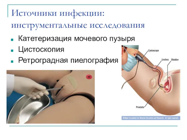 Источники инфекции: инструментальные исследования Катетеризация мочевого пузыря Цистоскопия Ретроградная пиелография