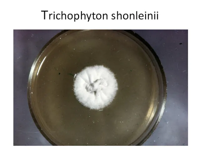 Тrichophyton shonleinii