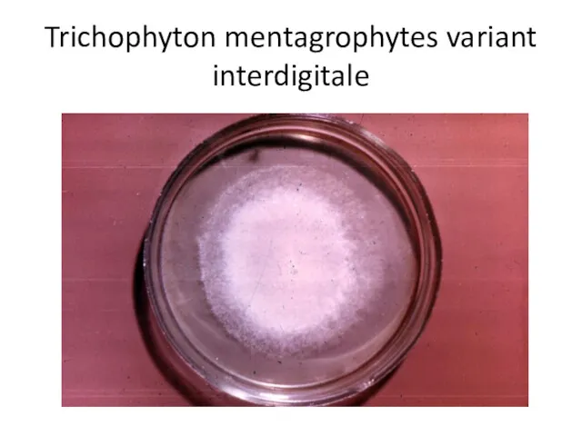 Trichophyton mentagrophytes variant interdigitale
