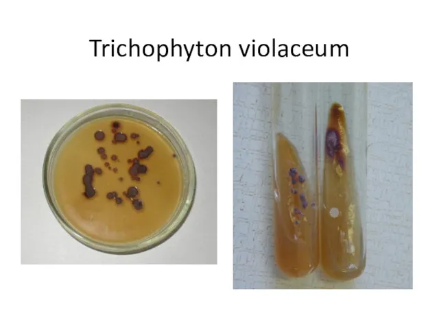 Trichophyton violaceum
