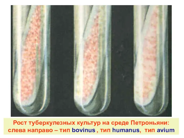 Рост туберкулезных культур на среде Петроньяни: слева направо – тип bovinus , тип humanus, тип avium