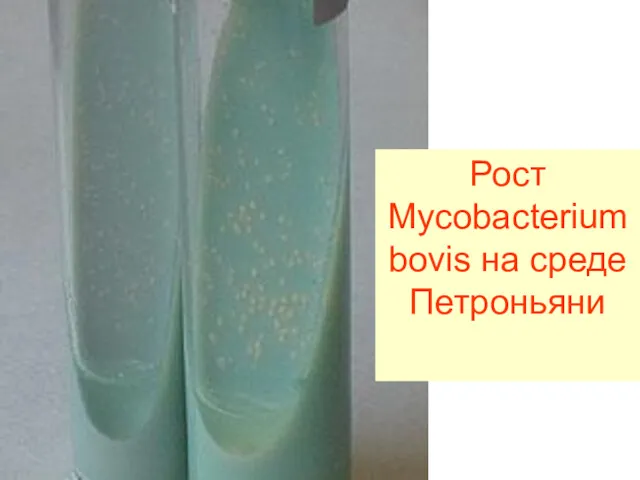 Рост Mycobacterium bovis на среде Петроньяни