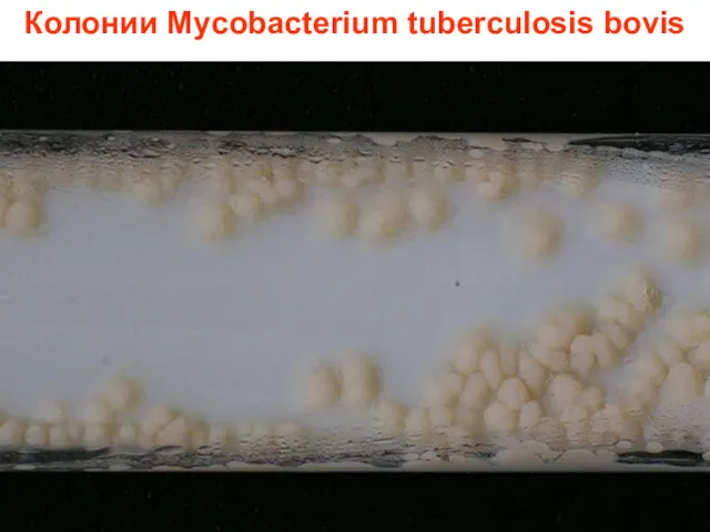 Колонии Mycobacterium tuberculosis bovis