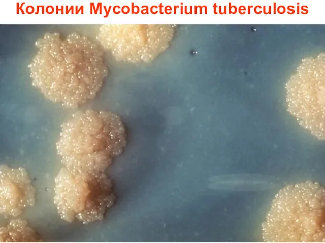 Колонии Mycobacterium tuberculosis