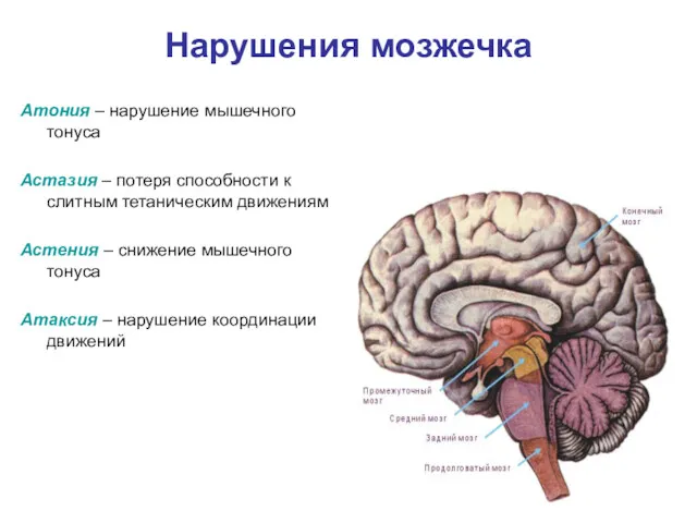 Нарушения мозжечка Атония – нарушение мышечного тонуса Астазия – потеря