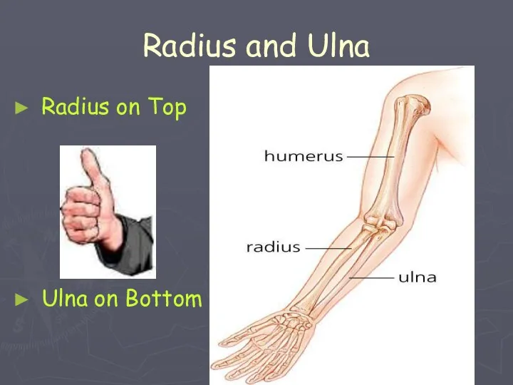 Radius and Ulna Radius on Top Ulna on Bottom