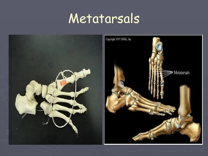 Metatarsals