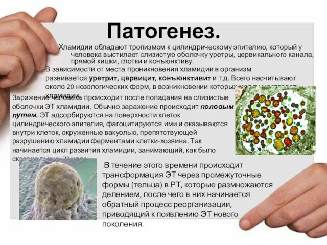 Патогенез. Хламидии обладают тропизмом к цилиндрическому эпителию, который у человека